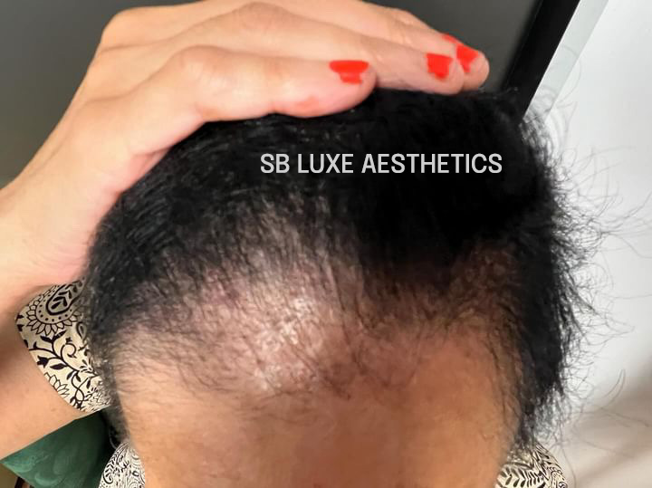 sb