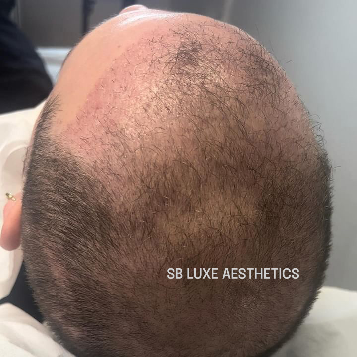 sb