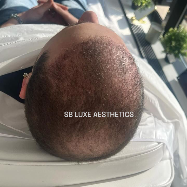 sb