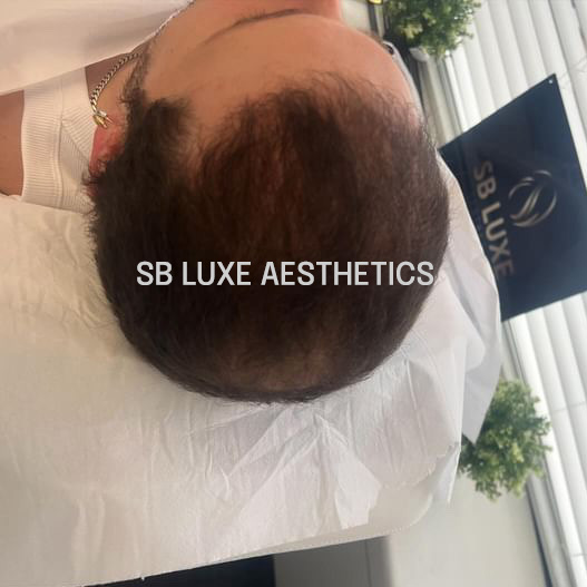sb